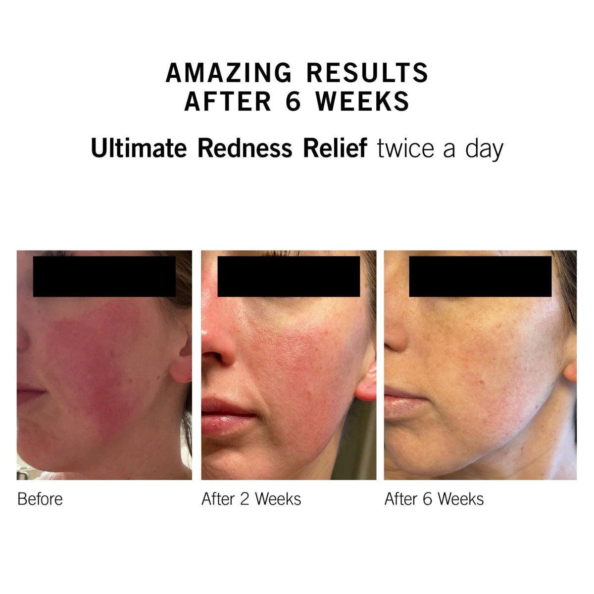 Neova Ultimate Redness Relief