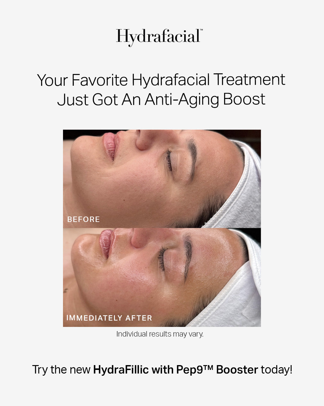 Hydrafacial Deluxe ( Series of 3)